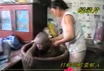 ​辽宁男子吃蛇竟然变“蛇人”，身上长出鳞片，蛇肉究竟能不能吃？