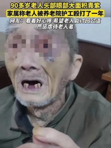 ​虐待老人?九旬老人惨遭养老院护工殴打一整年，多方发声 内情曝光