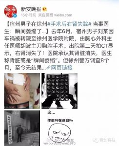 ​谣言：医生手术时“偷走”病人肾？