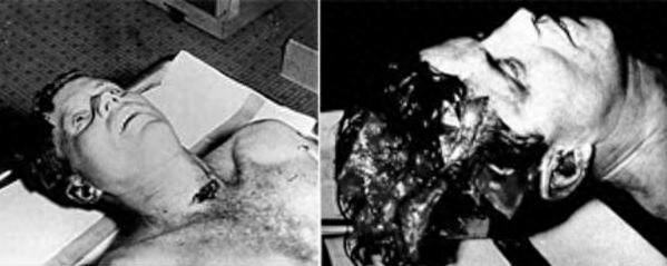 1963年肯尼迪总统遇刺,图2爆头瞬间,图4总统夫人飞身捡掉落头骨