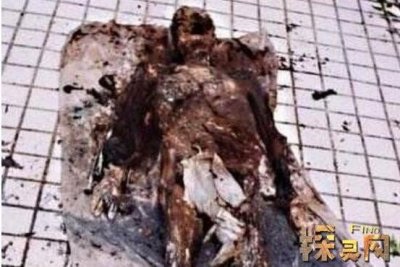 ​重庆男孩变僵尸事件，重庆僵尸男孩康复了吗
