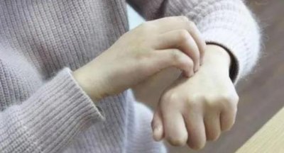 ​皮肤过敏的10种症状（灼热感也是其中一种）