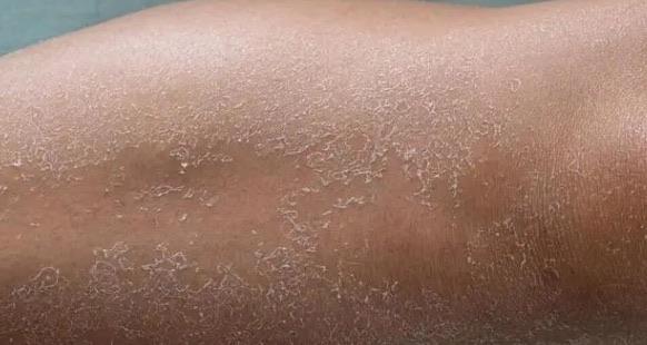 网络配图 网络配图