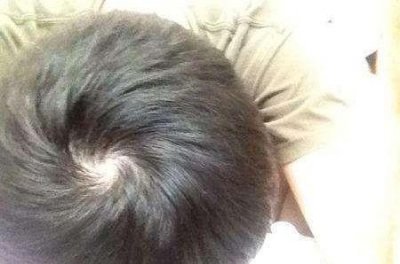 ​头上有四个旋的有什么说法(头顶三个发旋有什么说法)