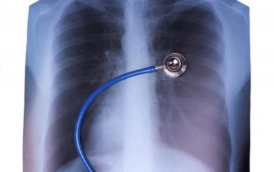 ​气管炎与支气管肺炎的主要区别(支气管肺炎与支气管炎的主要区别点是( ))