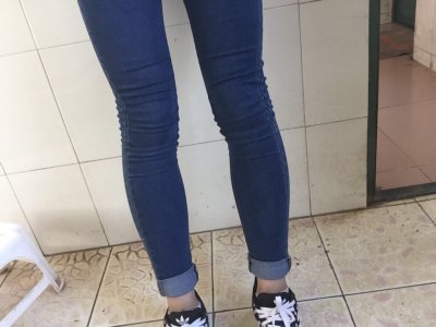 ​来看看你的腿是不是X型腿吧