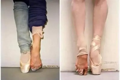 ​大家对于芭蕾的八大误区？你还在认为学芭蕾脚变形吗？