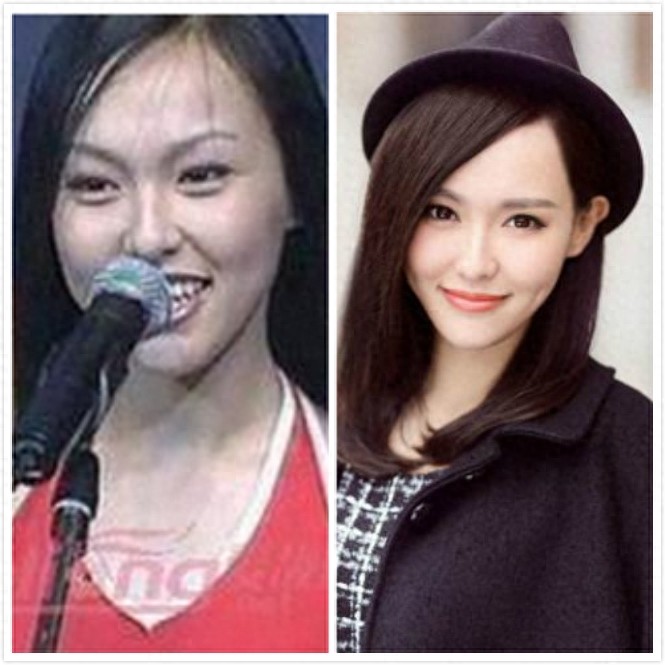 十大当红女星早期丑照对比，杨幂倒二，倒一居然是她。