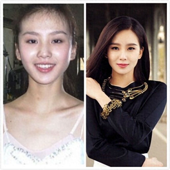 十大当红女星早期丑照对比，杨幂倒二，倒一居然是她。