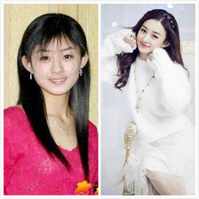 十大当红女星早期丑照对比，杨幂倒二，倒一居然是她。