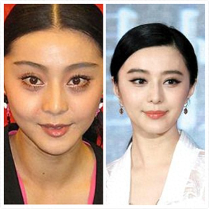 十大当红女星早期丑照对比，杨幂倒二，倒一居然是她。