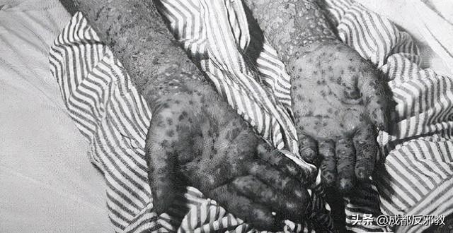 叙利亚引爆（叙利亚毒气袭击事件现场惨烈）(10)