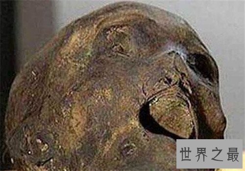 巨人观形成时间与影响 为什么会出现巨人观现象