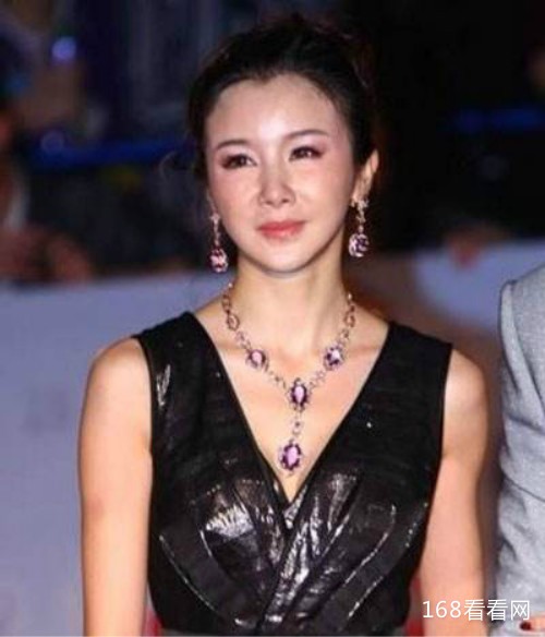 孙菲菲整容失败前后照片吓死人 孙菲菲踩裙门事件怎么回事真相揭