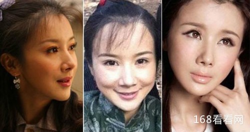 孙菲菲整容失败前后照片吓死人 孙菲菲踩裙门事件怎么回事真相揭